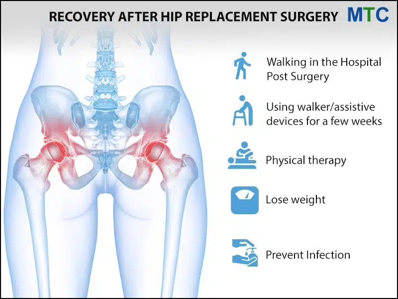 Hip Replacement Surgery in Mysore, India