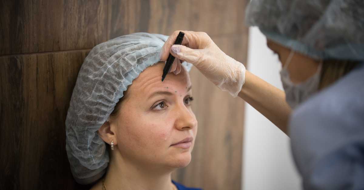 Brow Lift Surgery in Costa Rica