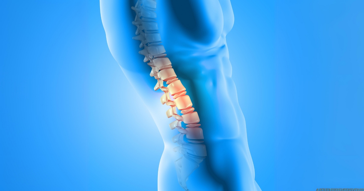 Cervical Spine Tumor & Multilevel Decompression Reconstruction Surgery in India – Testimonial