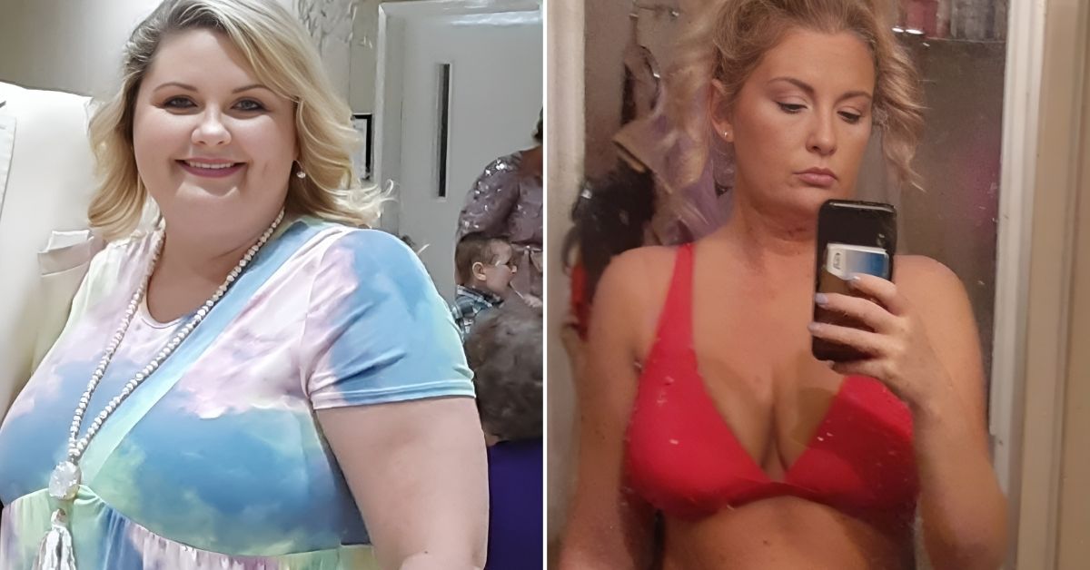 Weight Loss Surgery Testimonials